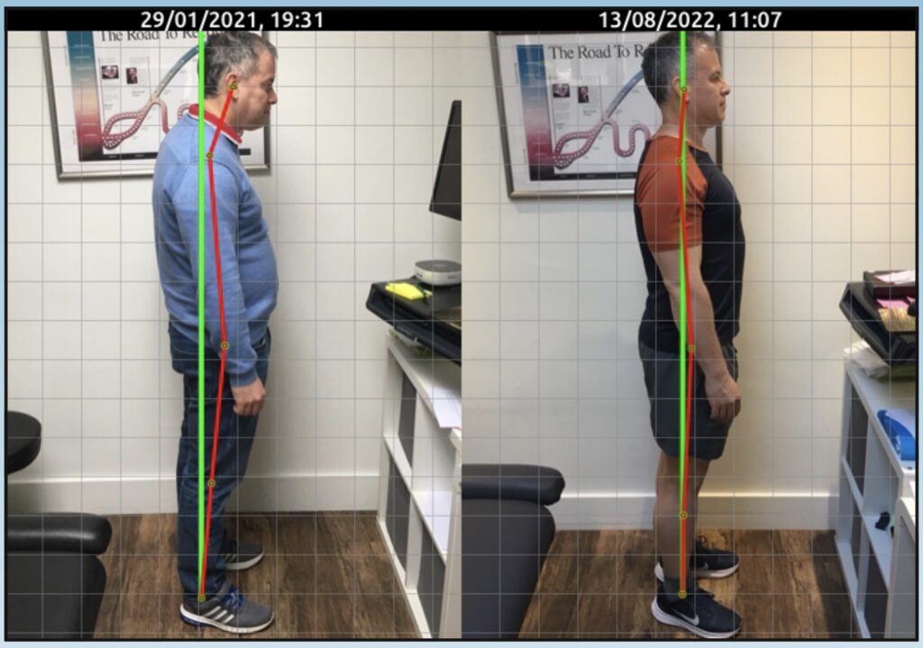 Posture correction